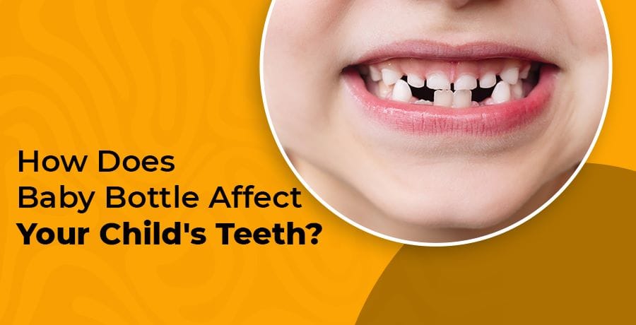 How Baby Bottle Affects your Child's Teeth?